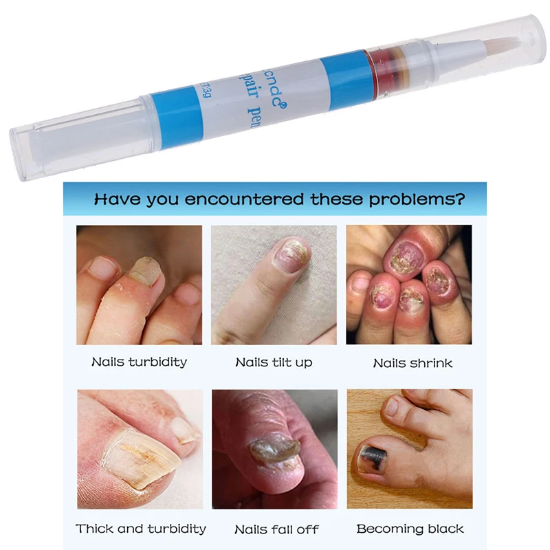 1PC Toenail Sēnītes Ārstēšana Pildspalvu Onychomycosis Paronīhija Pret Sēnīšu Ķīnas Augu izcelsmes Pirksta Nagu Sēnītes Ārstēšana